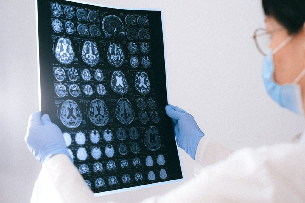 Understanding brain health is the key to improving brain function