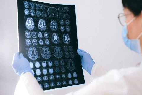 Understanding brain health is the key to improving brain function