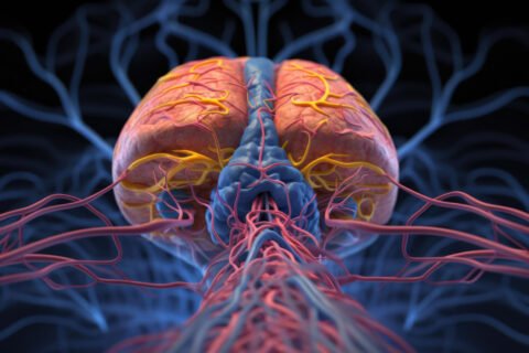 vascular dementia